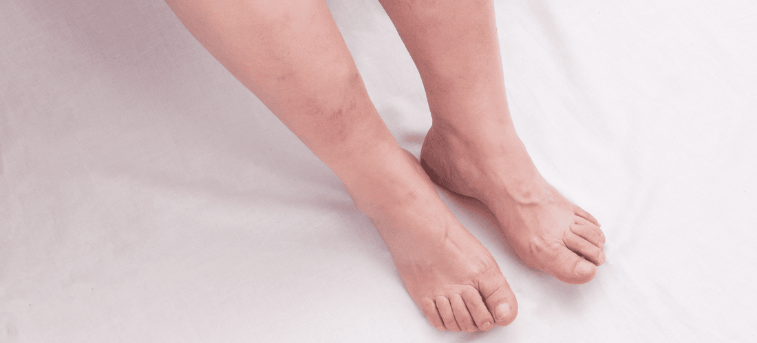 Circulation sanguine amélioration coussin orthopédique 