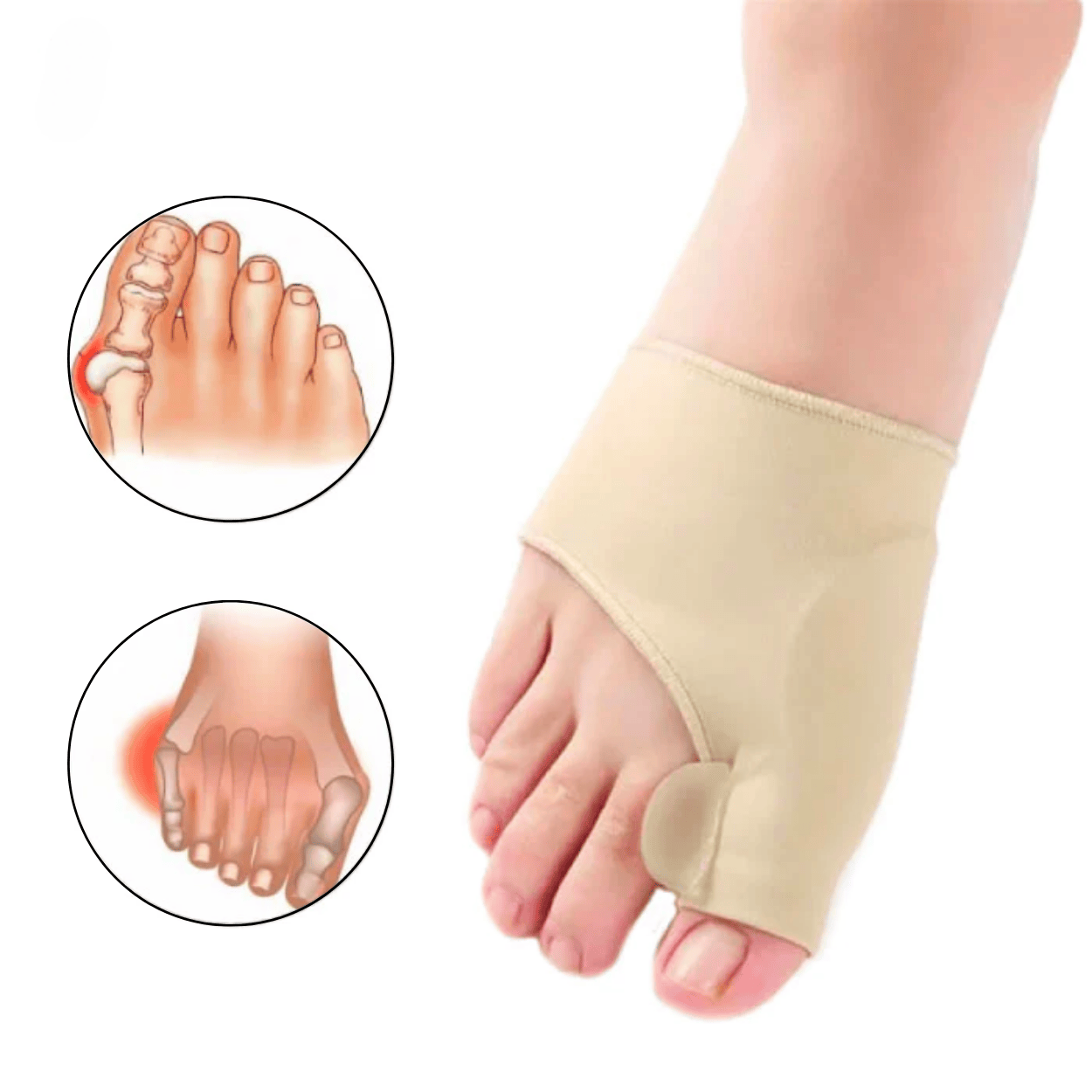 Orthèse Hallux orthese hallux valgus orthèse hallux valgus hallux valgus orthèse orthèse hallux valgus efficace orthese hallux valgus remboursé orthèse hallux valgus remboursé orthese hallux valgus nuit orthese hallux valgus silicone Oignon Orteil Levalor
