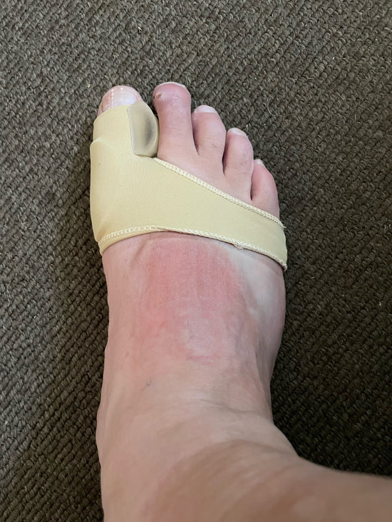 Orthèse Hallux orthese hallux valgus orthèse hallux valgus hallux valgus orthèse orthèse hallux valgus efficace orthese hallux valgus remboursé orthèse hallux valgus remboursé orthese hallux valgus nuit orthese hallux valgus silicone Oignon Orteil Levalor