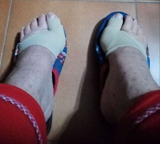 Orthèse Hallux orthese hallux valgus orthèse hallux valgus hallux valgus orthèse orthèse hallux valgus efficace orthese hallux valgus remboursé orthèse hallux valgus remboursé orthese hallux valgus nuit orthese hallux valgus silicone Oignon Orteil Levalor