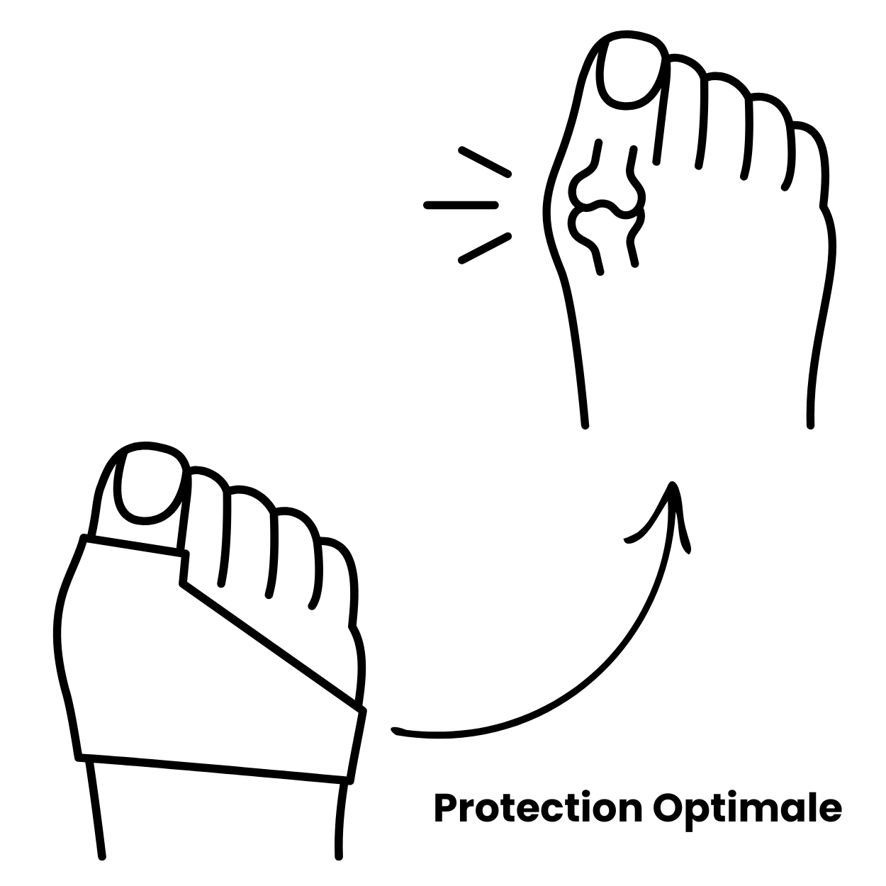 Orthèse pour hallux valgus, conçue pour soulager et corriger la déformation du gros orteil, offrant un confort optimal tout au long de la journée.